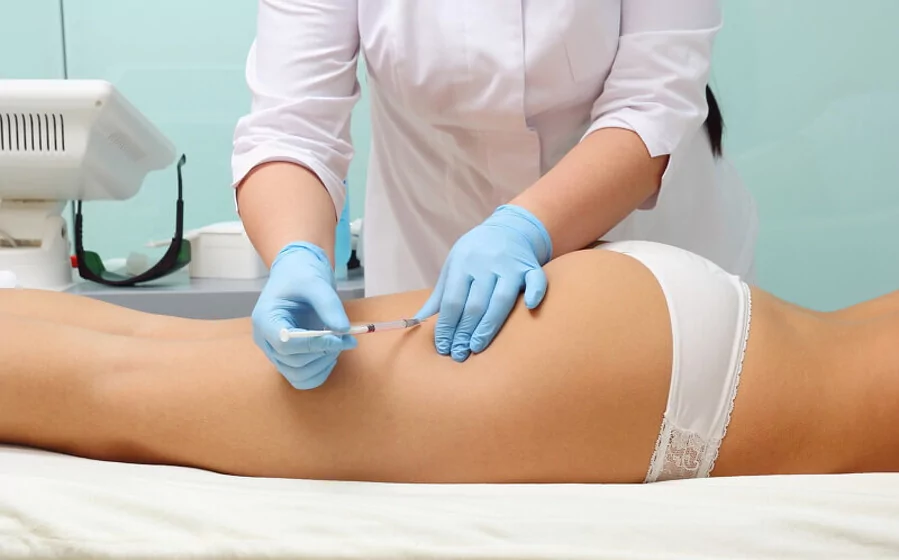 Cuánto duran los resultados mesoterapia